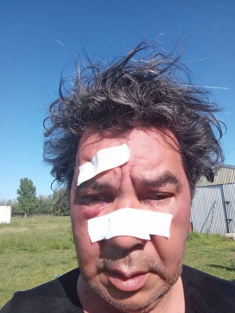  Cañuelas fue el escenario de odio hacia una pareja de lesbianas y su hija